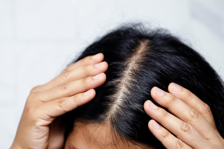 what is a scalp treatment