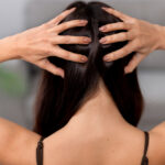 common scalp conditions